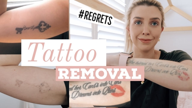 Pharrell Williams Gets Tattoos Removed