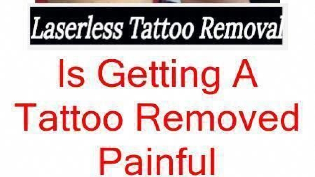 Tattoo Removal Methods – What Works And What Doesn’t