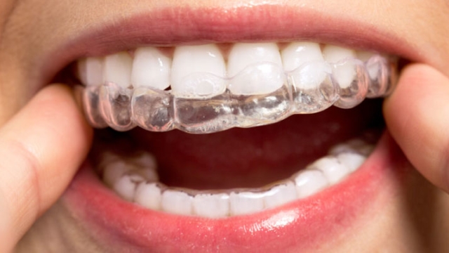 Perfecting Smiles: Unveiling the Magic of Orthodontics